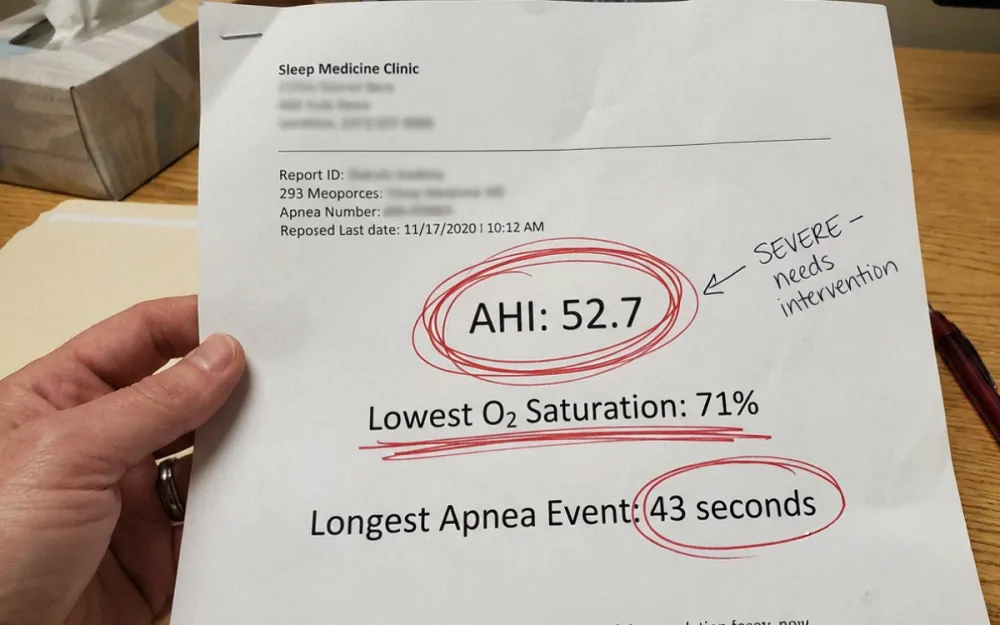 Sleep study results